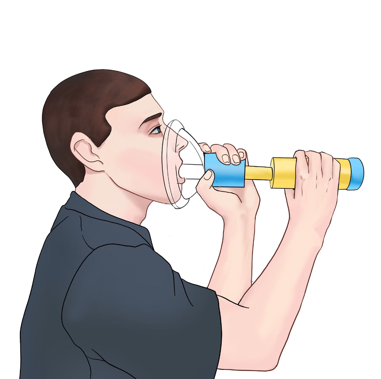 New Upgrade Portable Anti Choking Device Choking Emergency Life Saving Suction Vac Anti Choke Device First Aid Kit for Kid Adult - V.I.P Digital Presence