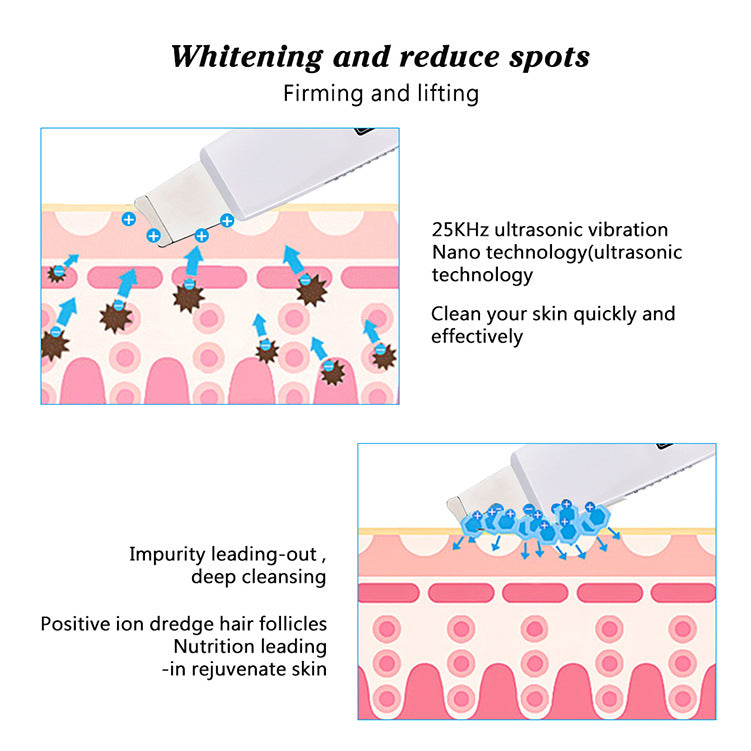 HailiCare Ultrasonic Peeling Machine To Remove Aging Horny Peeling Instrument Hydrogen And Oxygen Small Bubble Beauty - V.I.P Digital Presence