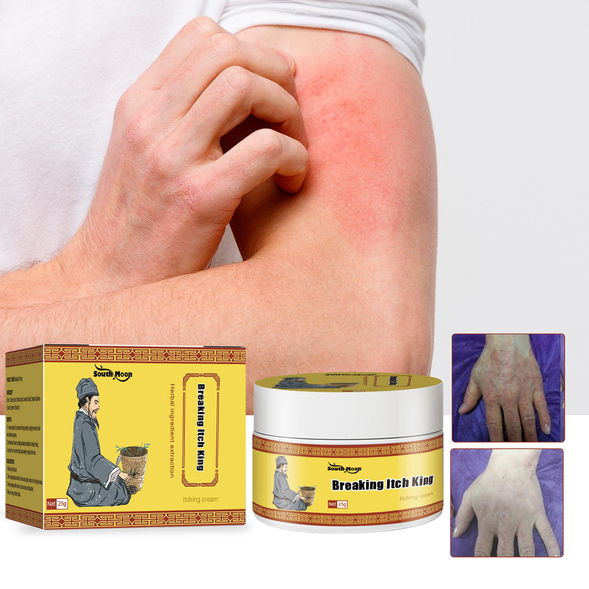 Breaking Itch King, Relieve Hand And Foot Moss Skin Moss Redness Repair Skin Itching Skin Care Cream - V.I.P Digital Presence