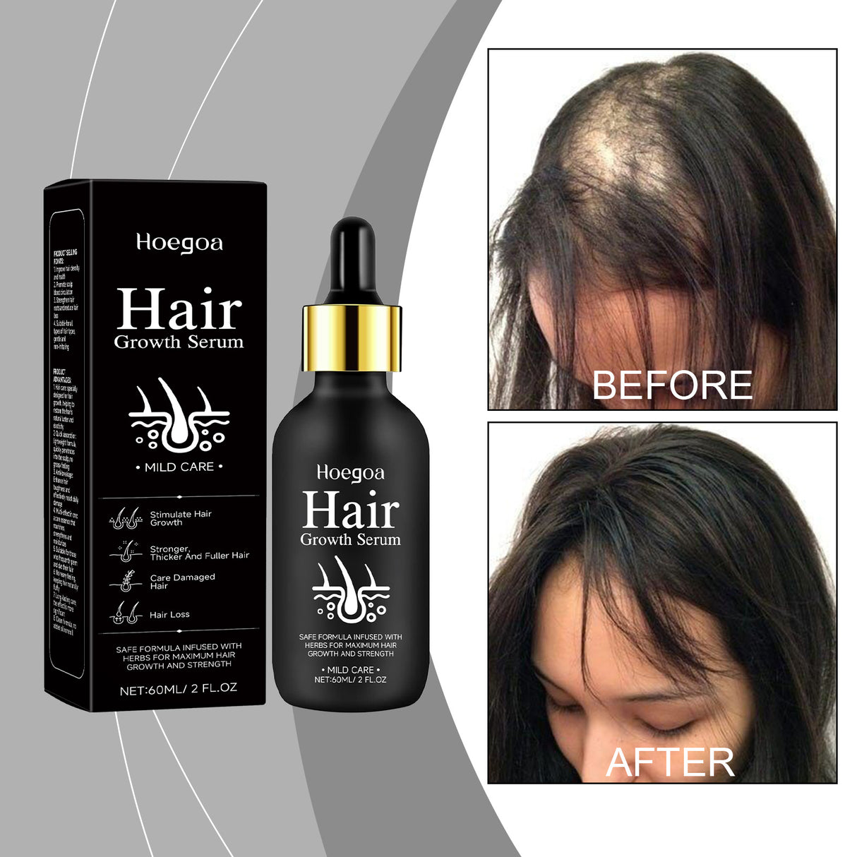 Hair Care Serum, Strengthens Hair And Nourishes Scalp Care Daily Massage Treatment Serum - V.I.P Digital Presence