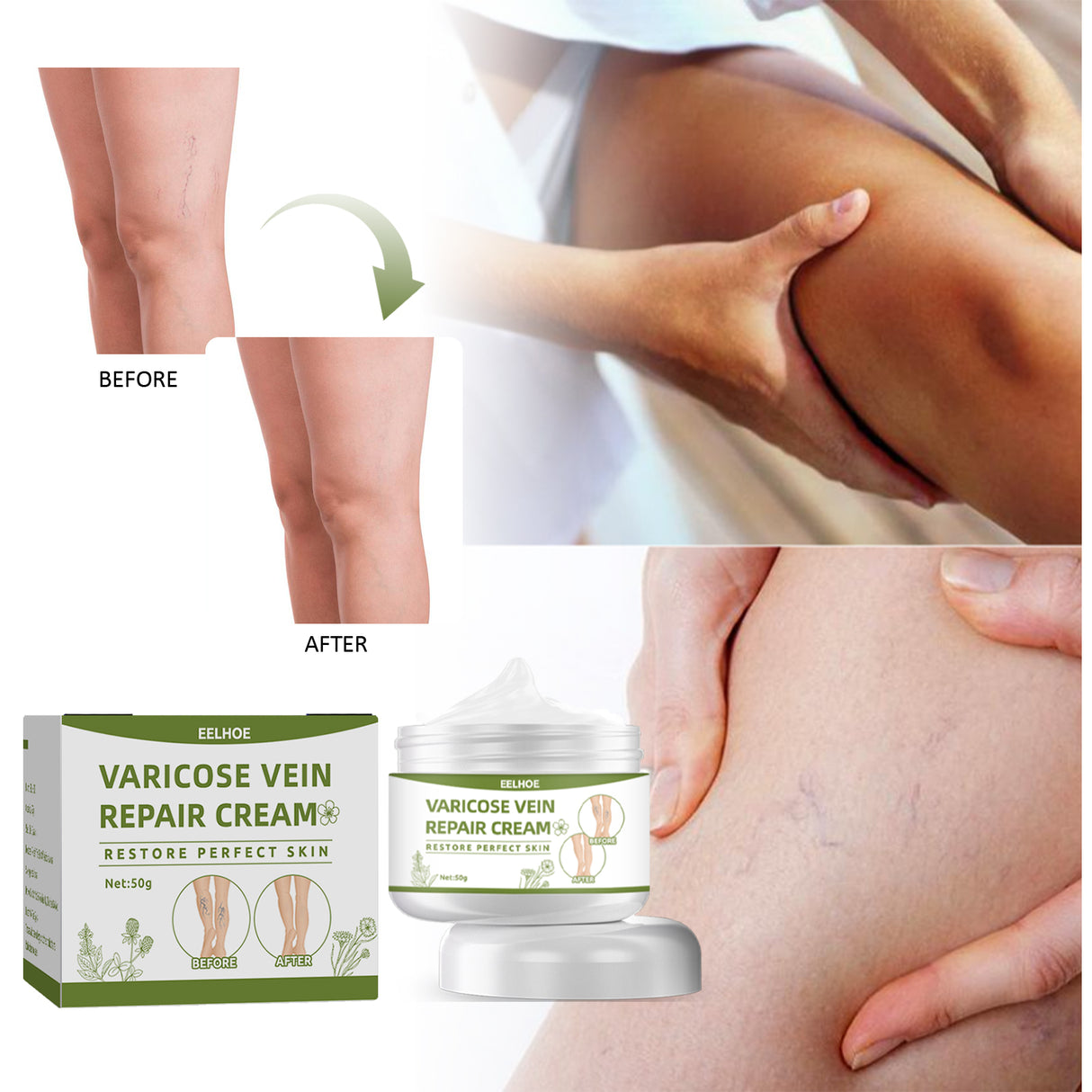 Leg Repair Cream Relieves Leg Discomfort Massage Leg Repair Cream For Raised Veins - V.I.P Digital Presence