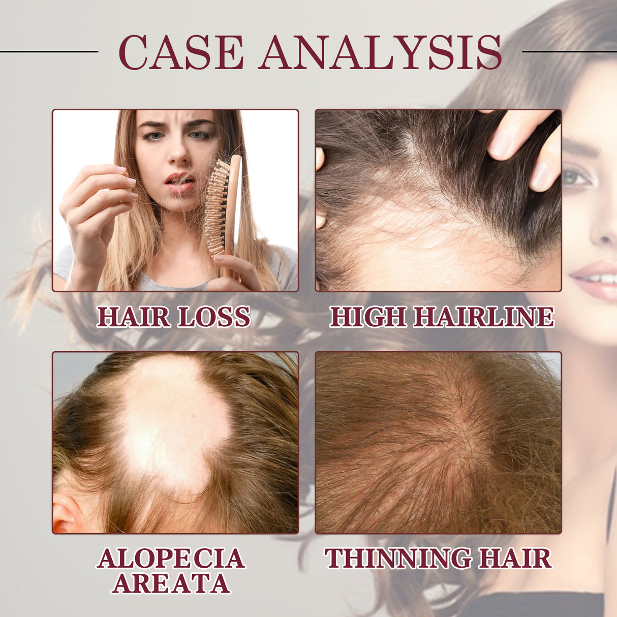 Onion Hair Growth Essential Oil, Strengthens And Hydrates Hair Growth Hair Dense Hair Care Spray - V.I.P Digital Presence