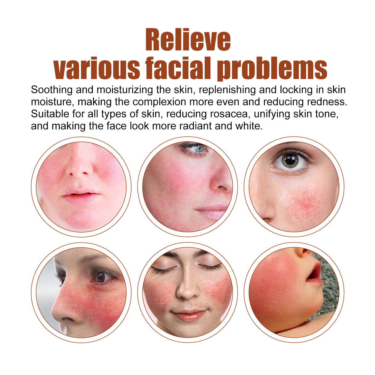 Erythematous Repair Essence, Repair Skin Lighten Facial Erythematous Moisturizing Essential Oil - V.I.P Digital Presence