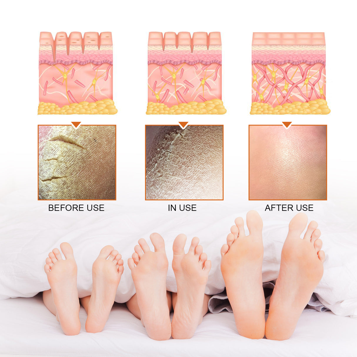 Exfoliating Treatment Spray Deep Clean Exfoliating Dead Skin Whitening And Tender Skin Spray