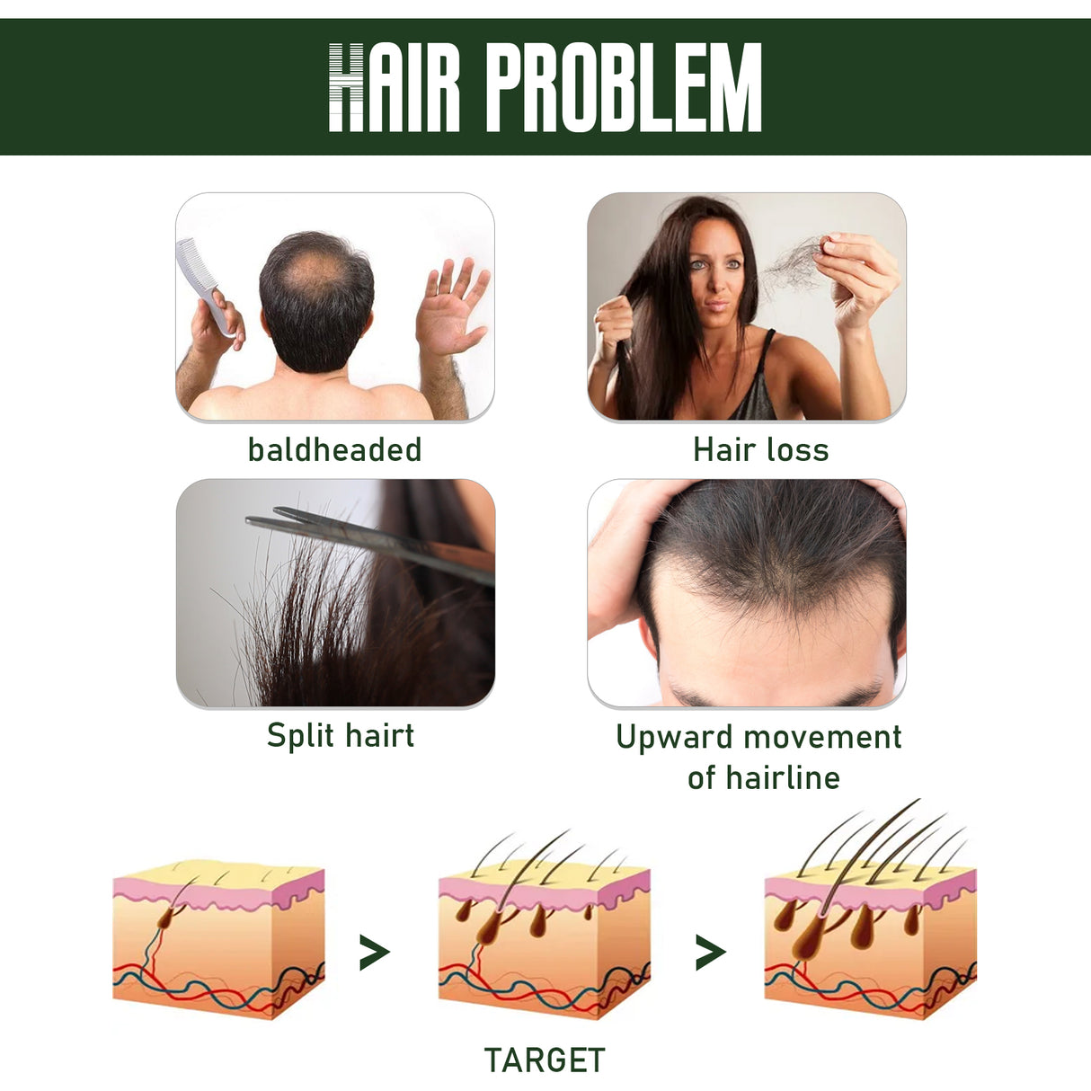 Ginger Dense Hair Spray Nourishes Hair Follicles, Prevents Hair Loss And Breaks, Moisturizes And Thickens Hair Spray - V.I.P Digital Presence