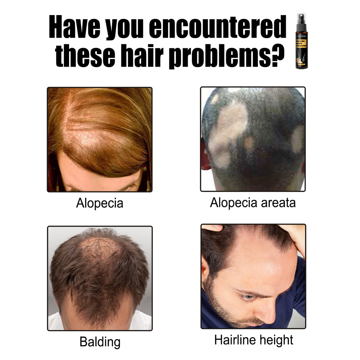 Herbal Hair Essence Spray,Prevent Falling Hair And Scalp Moisturizing And Nourishing Solution - V.I.P Digital Presence