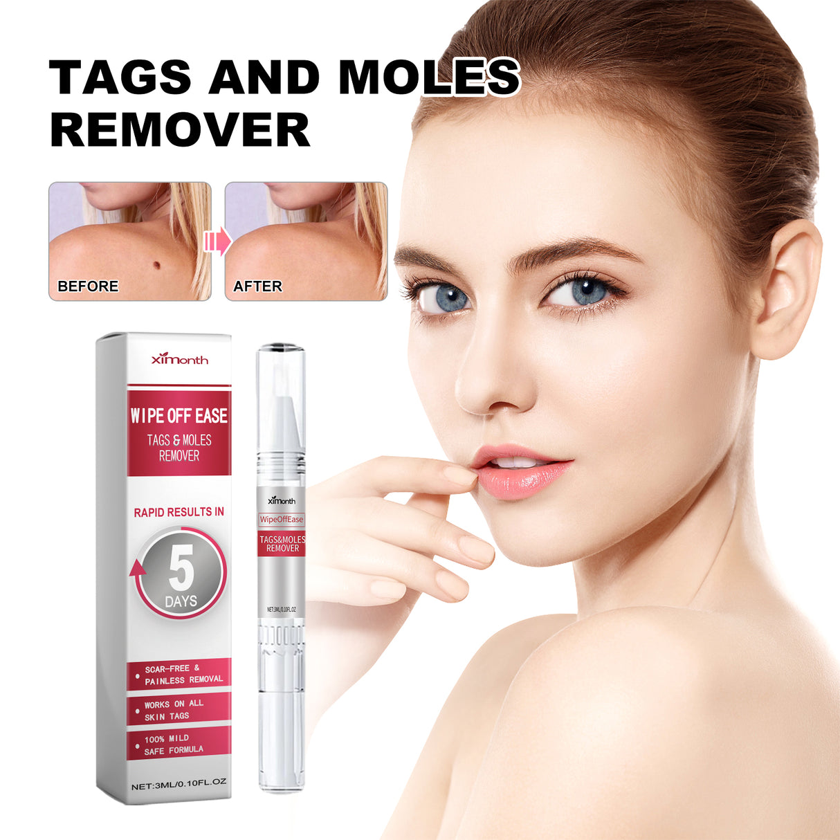 Skin Wart Lotion, Cleanses Skin And Removes Flat Eye Wart Lotion Especially Hand Cocoon - V.I.P Digital Presence