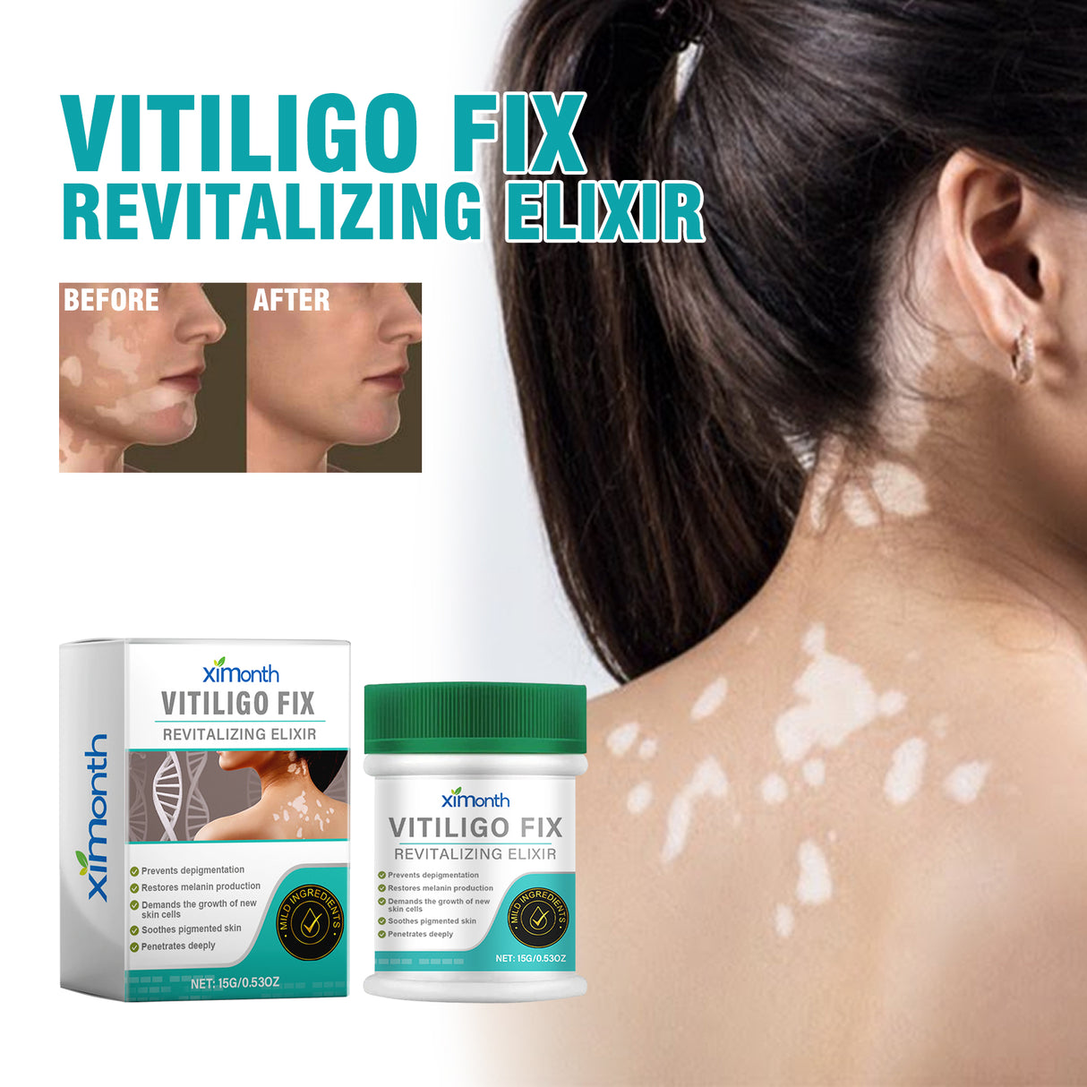 Vitiligo Fix Revitalizing Elixir, Lighten Skin Spots Even Skin Tone Moisturizing Body Care Repair Cream - V.I.P Digital Presence