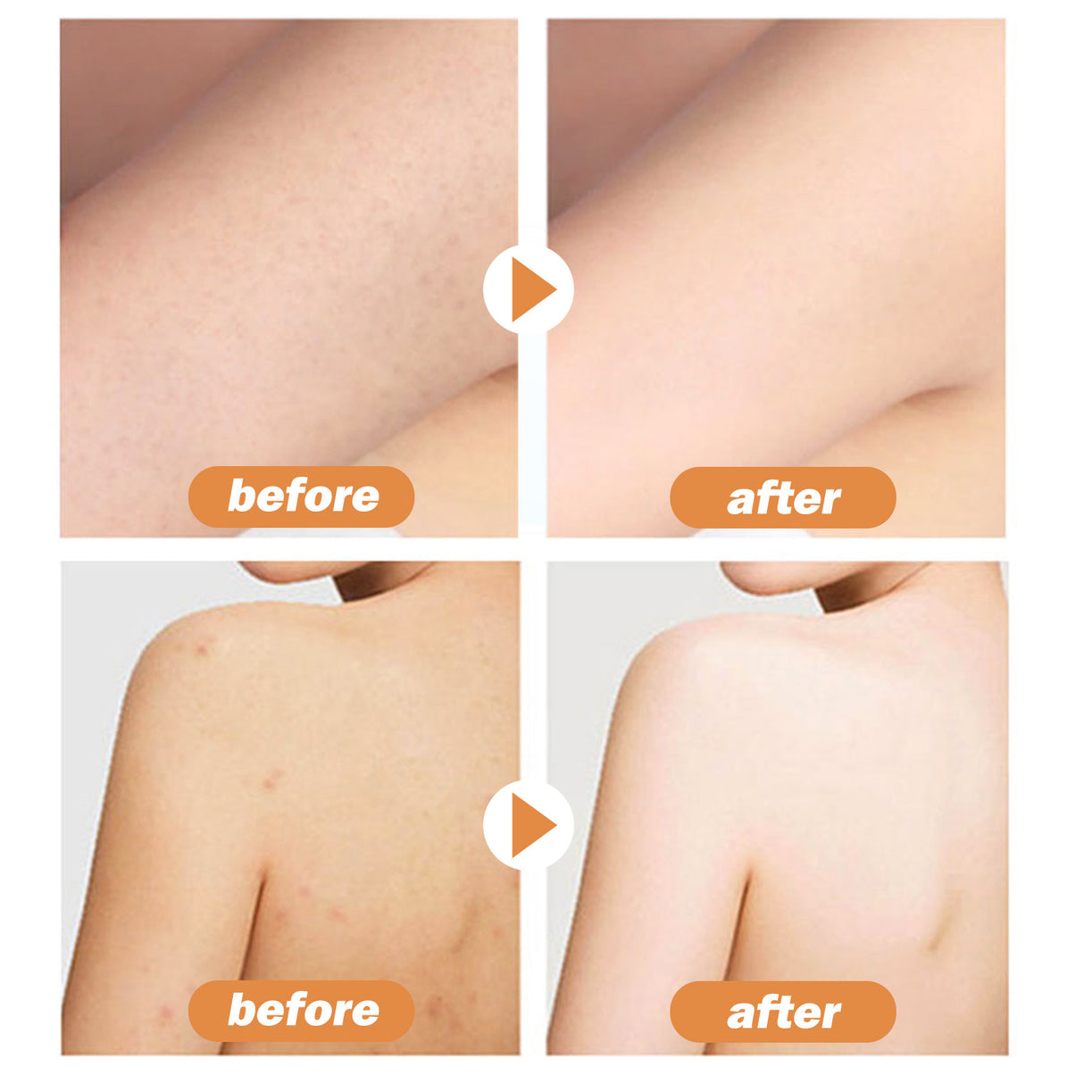 Cacao Body Lotion, Lightening Acne Mark Dark Hydrating Whitening Body Lotion