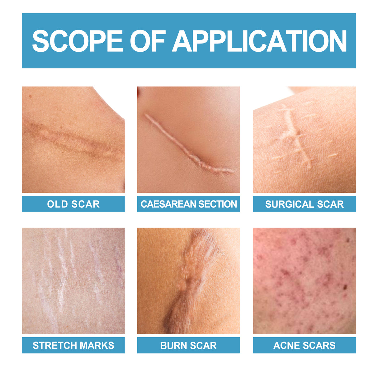 Scar Repair Serum Lightens Post-Pregnancy Scar Repair And Smoothes Body Skin - V.I.P Digital Presence