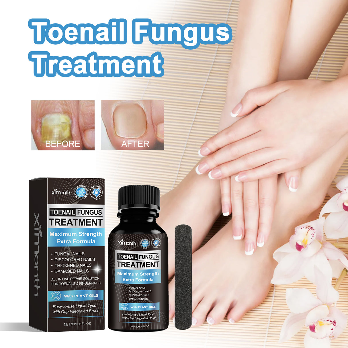 Toenail Fungus Treatment, Repair The Brotherhood Of Nails Rotten Jiasheng Mail This Soft Armour A Detailer - V.I.P Digital Presence
