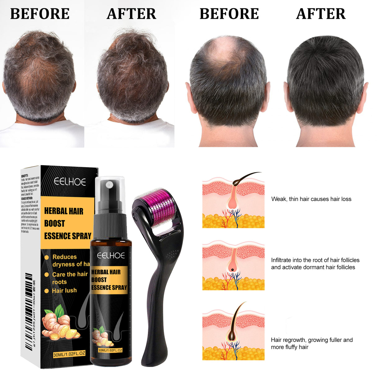 Herbal Hair Essence Spray,Prevent Falling Hair And Scalp Moisturizing And Nourishing Solution - V.I.P Digital Presence