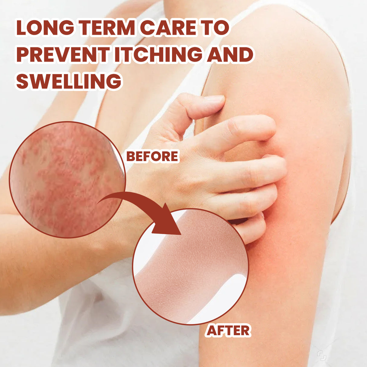 Breaking Itch King, Relieve Hand And Foot Moss Skin Moss Redness Repair Skin Itching Skin Care Cream - V.I.P Digital Presence