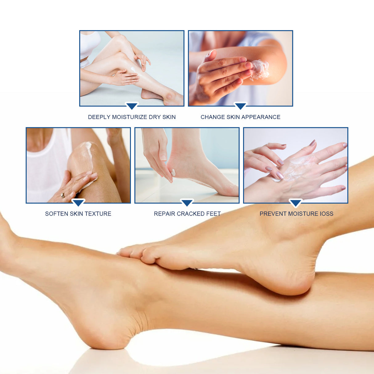 Body Repair Cream, Relieve Peeling Improve Chapped Dry Skin And Remove Dead Skin Moisturize Cream - V.I.P Digital Presence