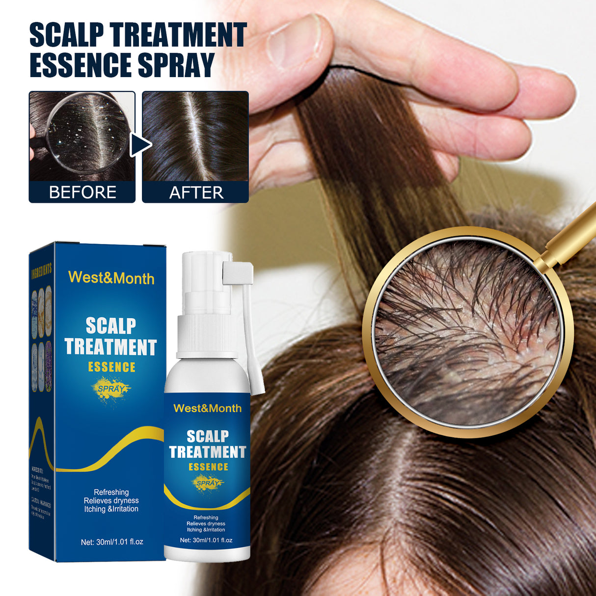 Scalp Treatment Essence Spray, Hair Care And Repair Damaged Hair Follicle Hair Root Treatment Spray - V.I.P Digital Presence