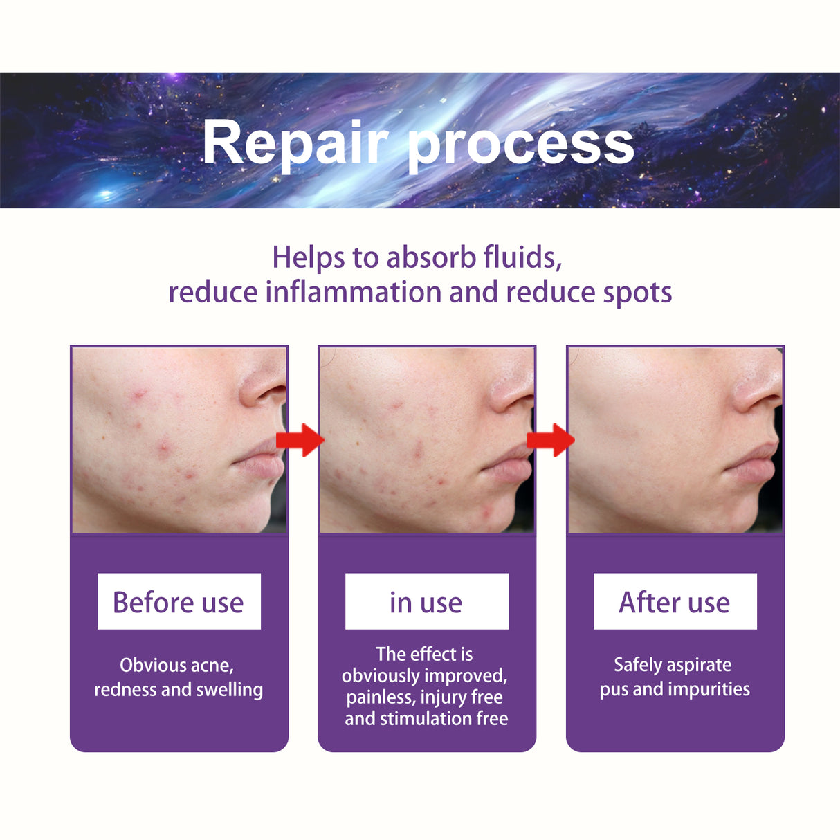 Acne Patch, Fade Closed Mouth Acne, Clear Acne, Waterproof Breathable Repair Acne Muscle Pattern Acne Patch