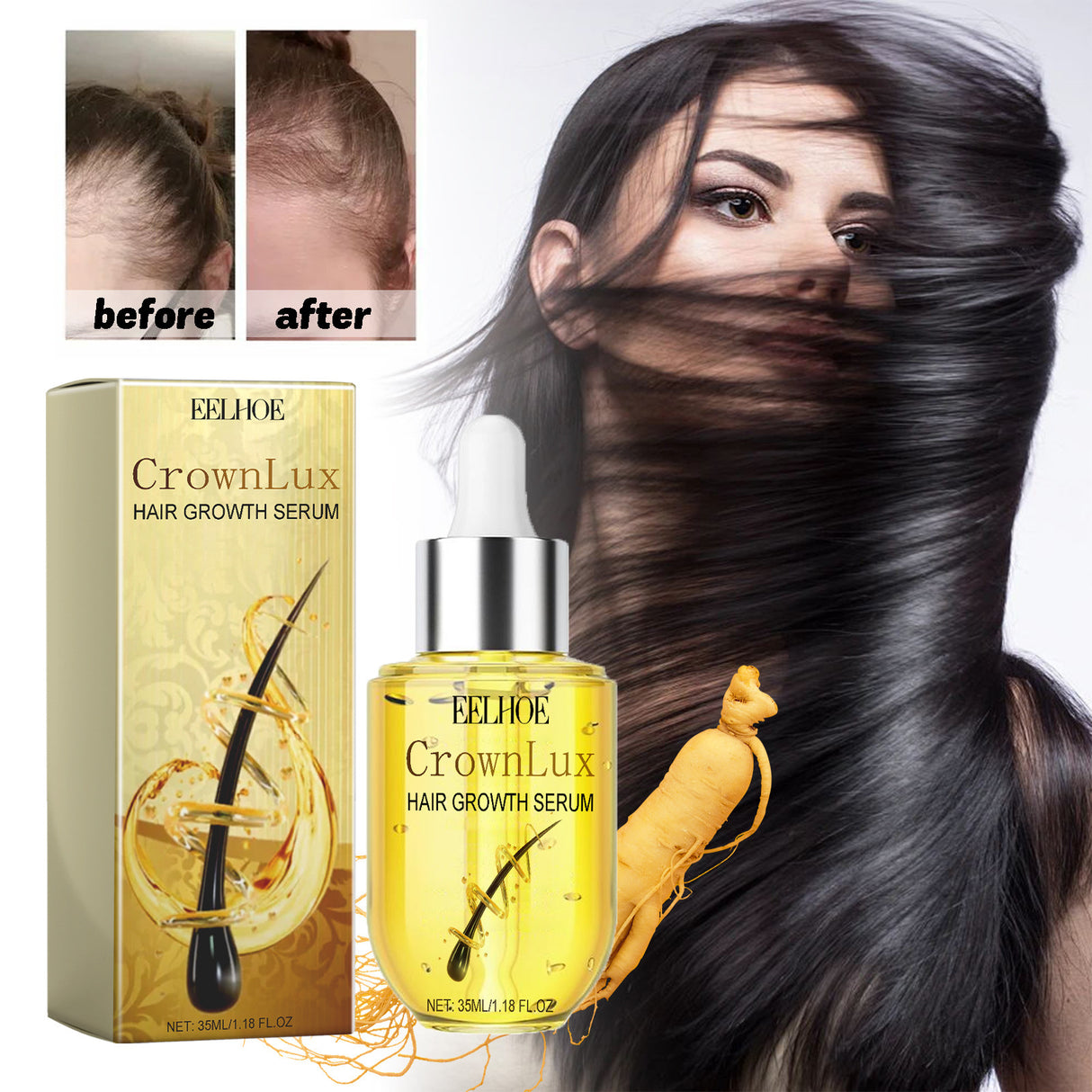 Hair Growth Serum, Prevent Fixation And Nourish Thick Hair And Scalp - V.I.P Digital Presence