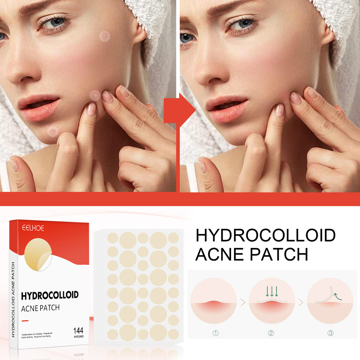 Hydrocolloid Acne Patch Face Invisible Makeup Closed Mouth Acne Clear Acne Waterproof Breathable Facial Treatment - V.I.P Digital Presence