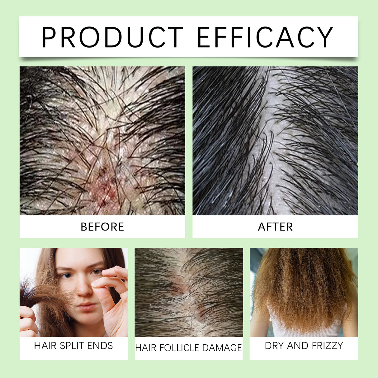Hair Care Conditioner Scalp Root Care Care Nourishes Hair Follicles Hair Shine Conditioner - V.I.P Digital Presence