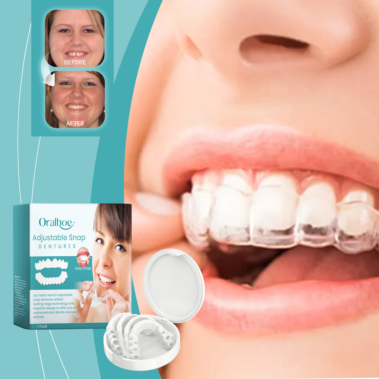 Adjustable Buckle Dentures, Comfortable Adjustable Dentures To Fit The Mouth Chewing Force And Fit The Teeth - V.I.P Digital Presence