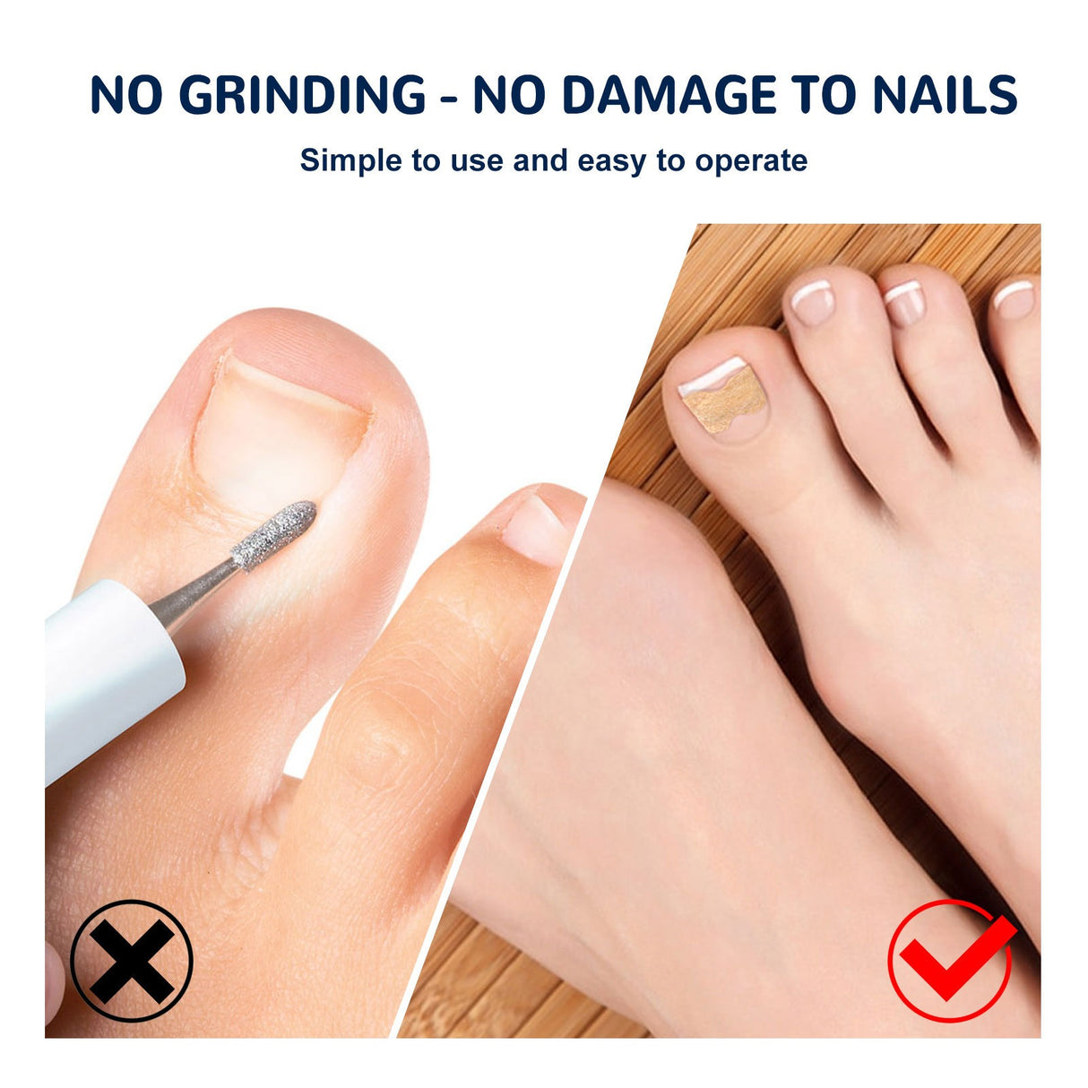 EELHOE toe nail correction patch - V.I.P Digital Presence