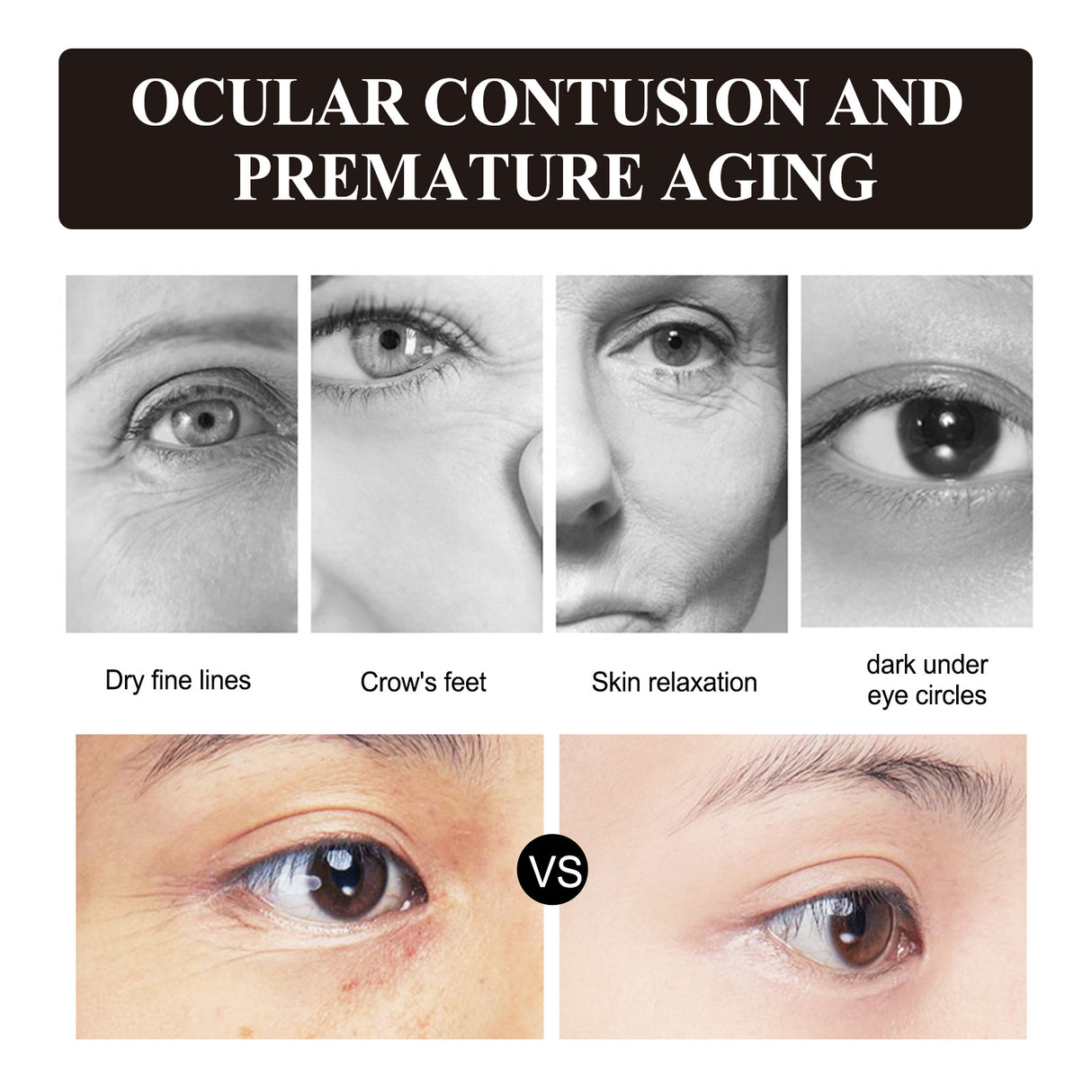 Retinol Eye Cream, Desalination Smoothen Fine Lines Eye Pouch Black Rim Of The Eye Moist Nursing Play Tight Muscle Eye Cream - V.I.P Digital Presence