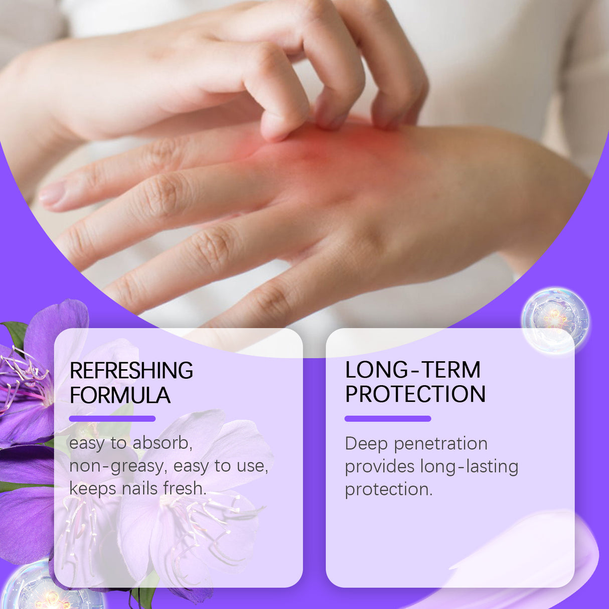 Violet Skin Repair Cream Gently Moisturizes Body Skin And Relieves Dry, Flushed Skin Care