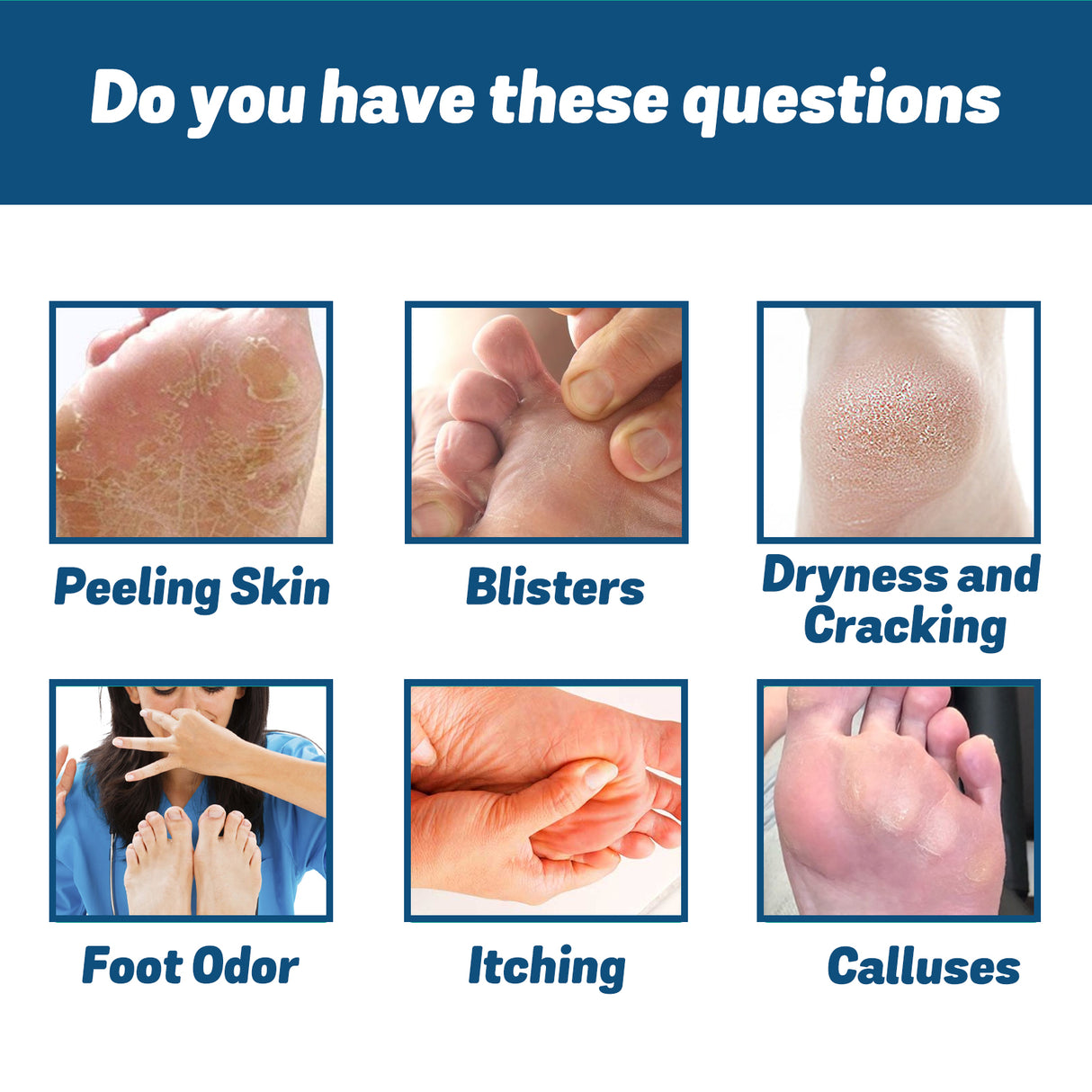 Medical Nail Fungus Foot Spray, Repair Thickening Gray Nail Rot Foot Moisturizing And Cleansing Armor - V.I.P Digital Presence