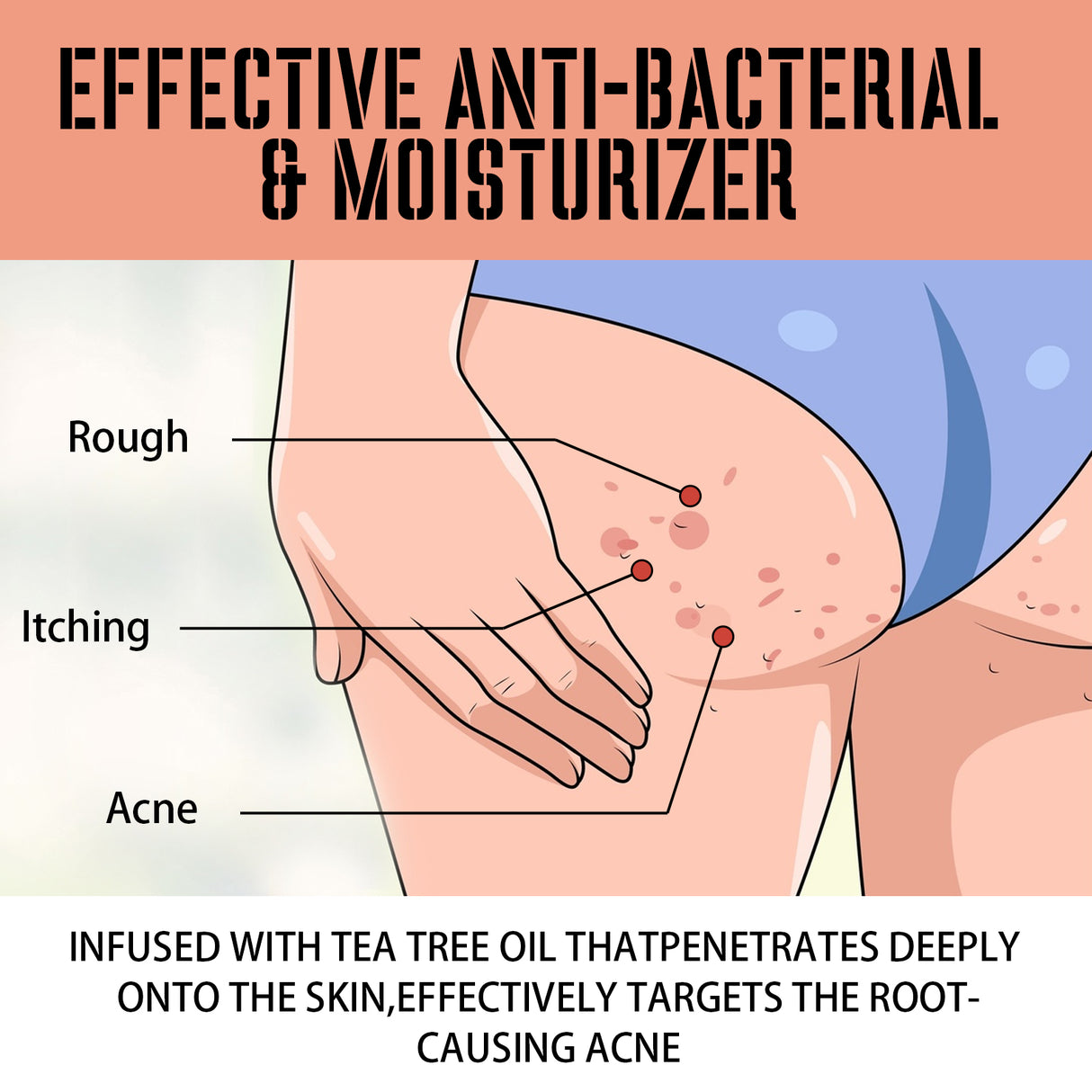 Buttock Care Cream, Repair Rough Buttock Skin Gentle Care Moisturizing And Moisturizing Skin - V.I.P Digital Presence