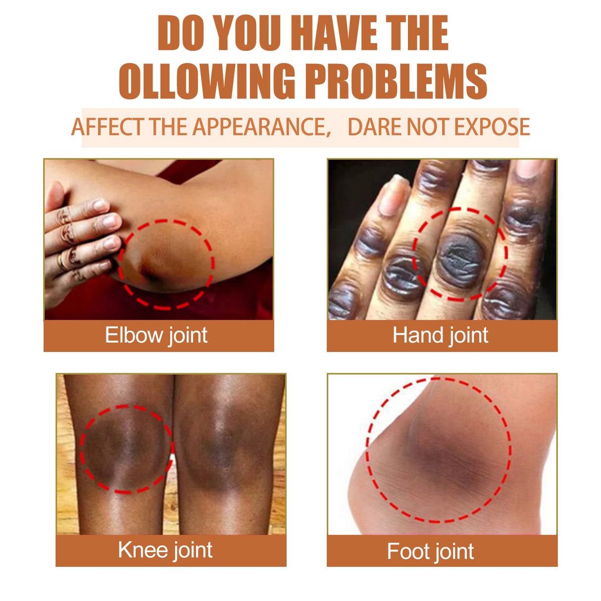 Papaya Seed Skin Care Oil Lightening Dark Spots, Bending Joints, Elbows, Brightening Skin And Moisturizing Oil - V.I.P Digital Presence