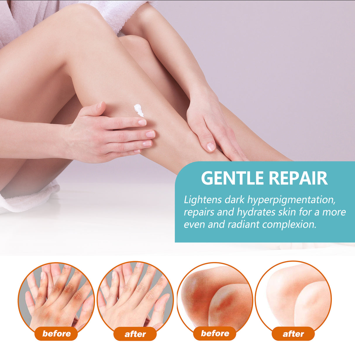 Black Acanthoderm Repair Cream Repair Underarm Arm Knee Joint Black Moisturizing Whitening Body Care Cream - V.I.P Digital Presence