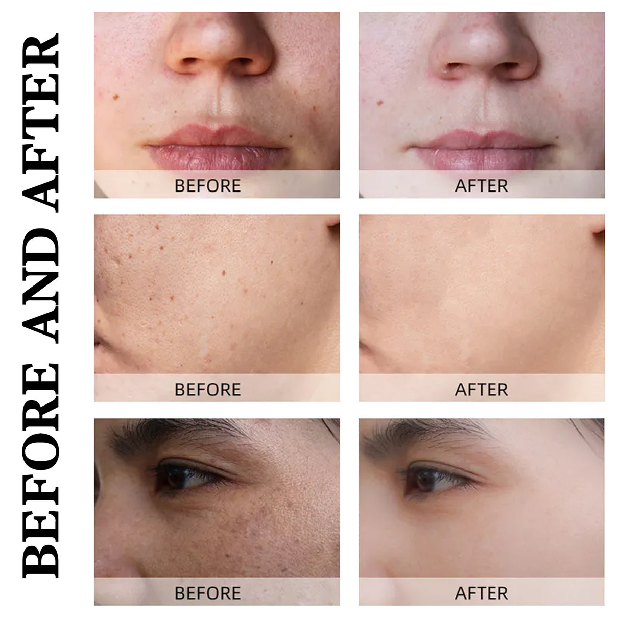 Calendula Peel Mask, Clean Keratin Delicate Pores Brightening Skin And Oil Control Mask