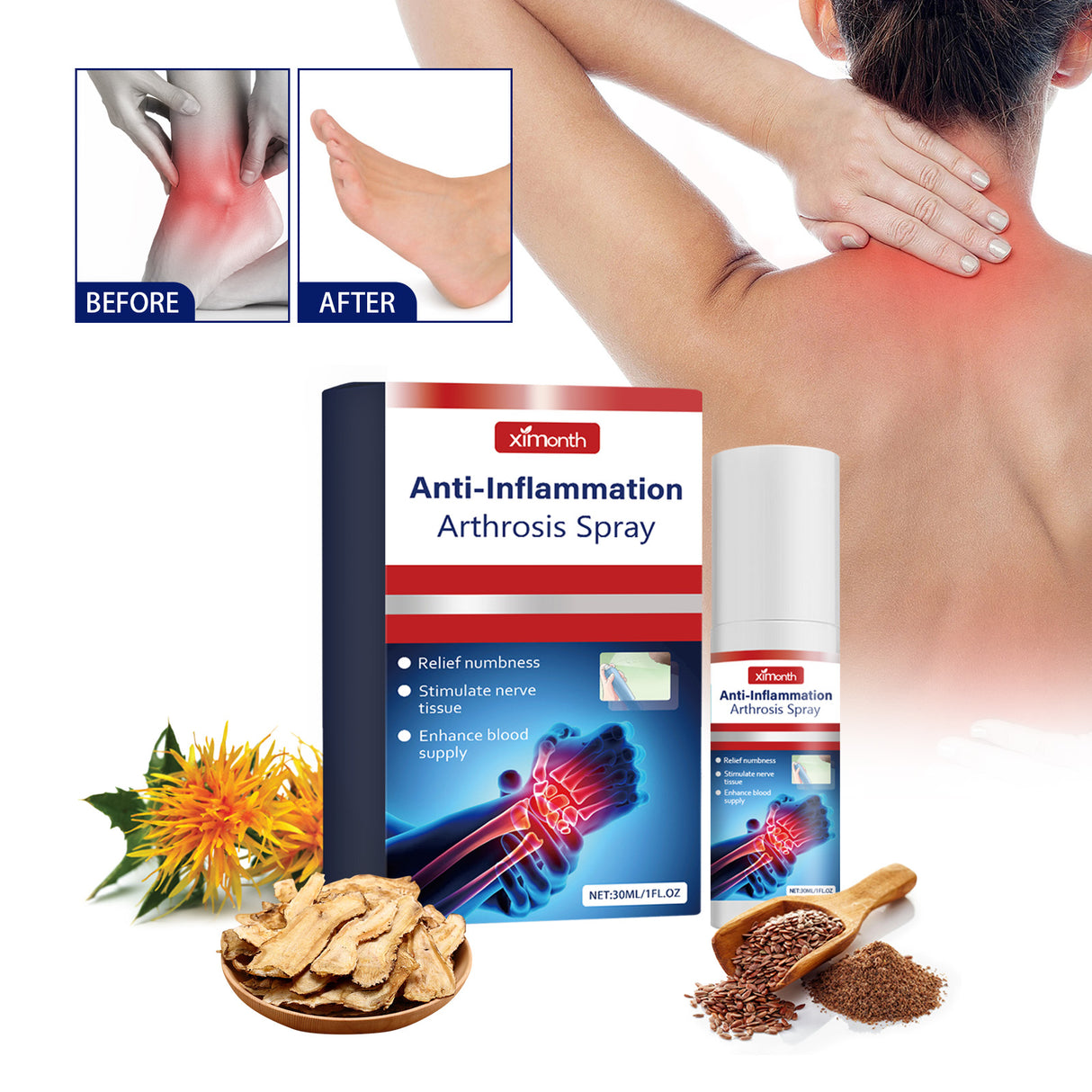 Anti-Inflammation Arthrosis Spray, Relieve Knee Shoulder Neck Pain Body Joint Health Care Spray - V.I.P Digital Presence
