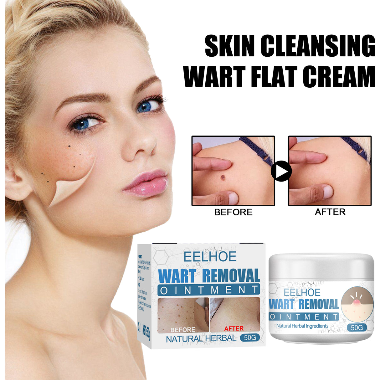 Wart Cream, Skin Clean And Smooth Wart Nevi Facial Care Cream - V.I.P Digital Presence