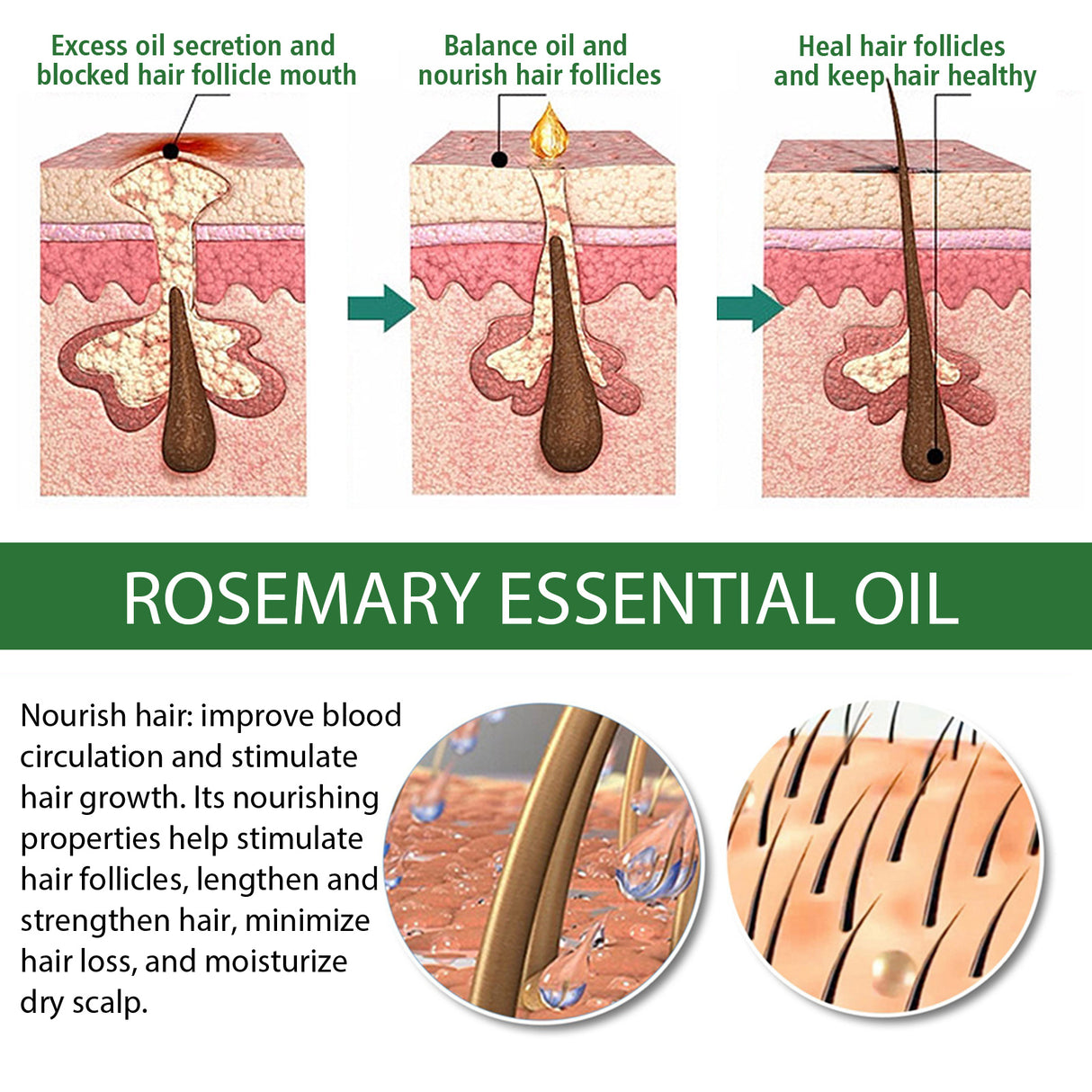Multi-Effect Rosemary Essential Oil, Strengthens Hair Moisturizes And Thickens Hair And Skin Care Multi-effect Essential Oil - V.I.P Digital Presence