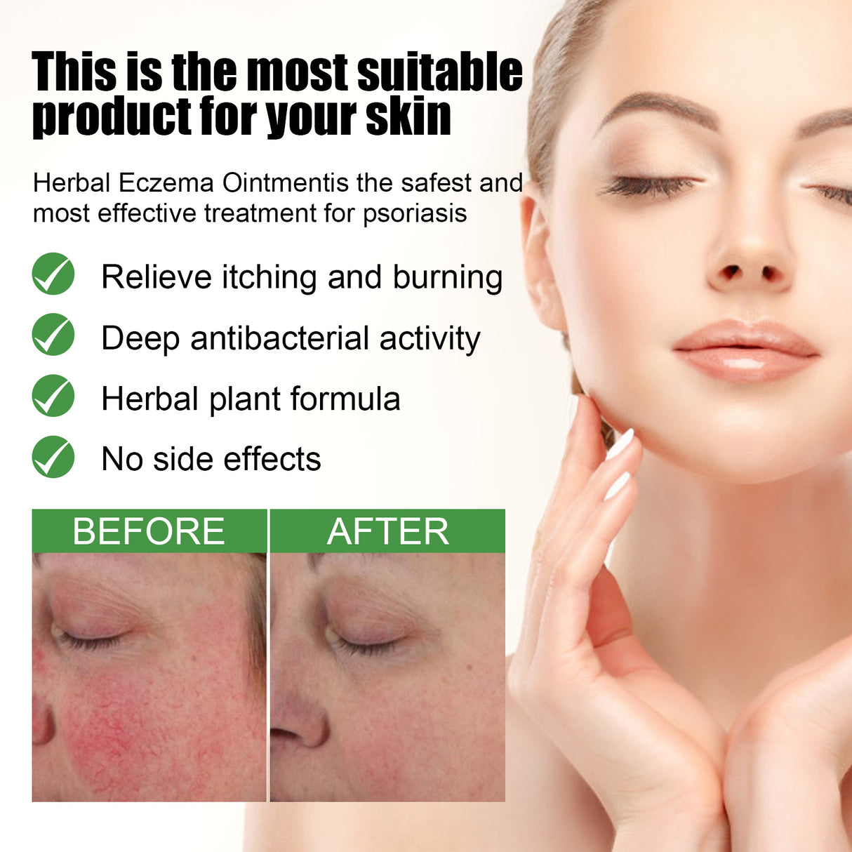 Herbal Eczema Ointment, Relieve Hand And Foot Moss Skin Redness Itchy Skin Repair Ointment - V.I.P Digital Presence