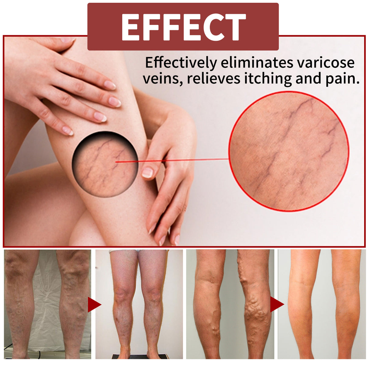 Venous Massage Varicose Cream, Relieves Bulging Leg Blood Vessels And Swollen Leg Earthworm Venous Massage Cream - V.I.P Digital Presence
