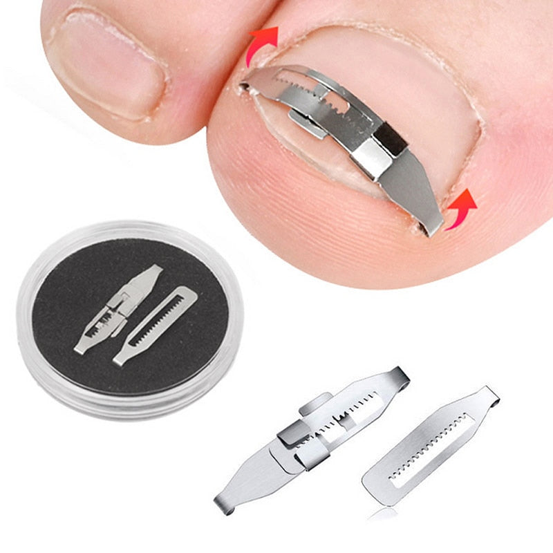 Ingrown Toenail Corrector Tools Pedicure Recover Embed Toe Nail Treatment Professional Ingrown Toenail Correction Foot Care Tool - V.I.P Digital Presence