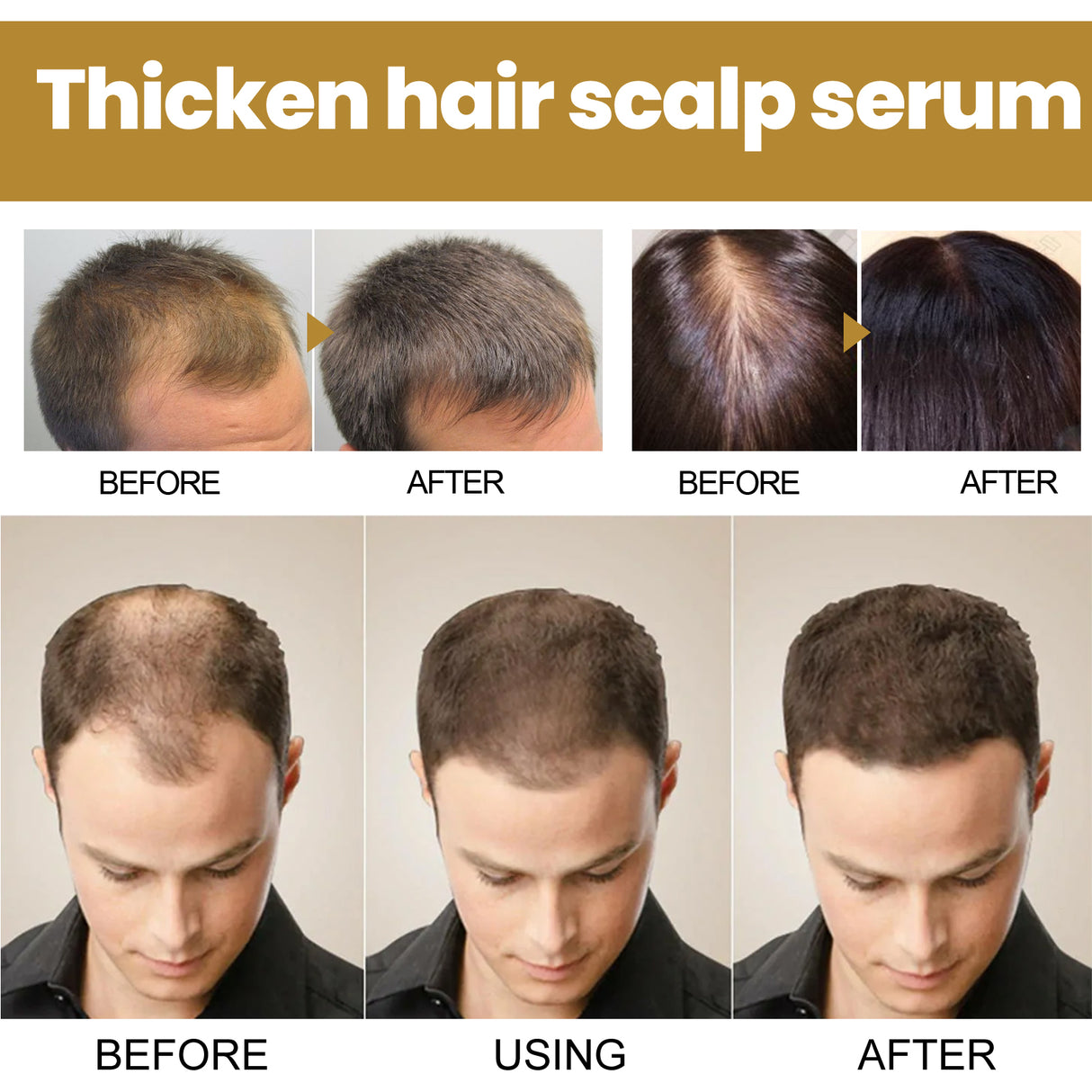 Tight Hair Shampoo Hair Cleansing Massage Scalp To Prevent Loose Tight Hair Roots Strong And Solid Hair Shampoo - V.I.P Digital Presence