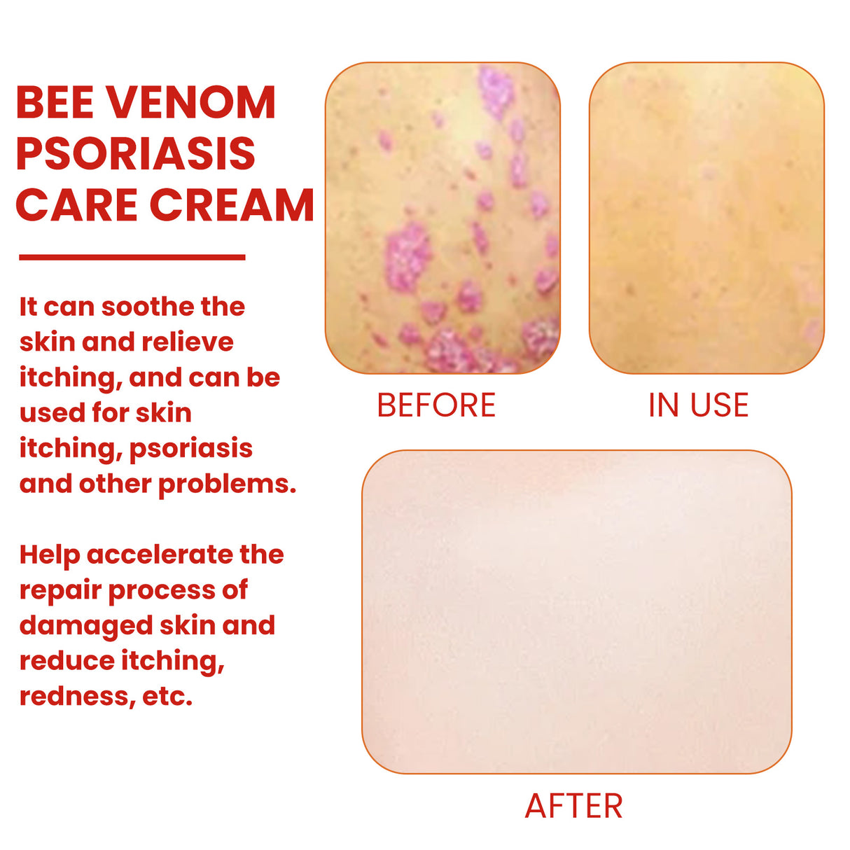 Bee-Poison Cowhide Moss Cream, Which Relieves Redness And Itchiness Of Skin - V.I.P Digital Presence