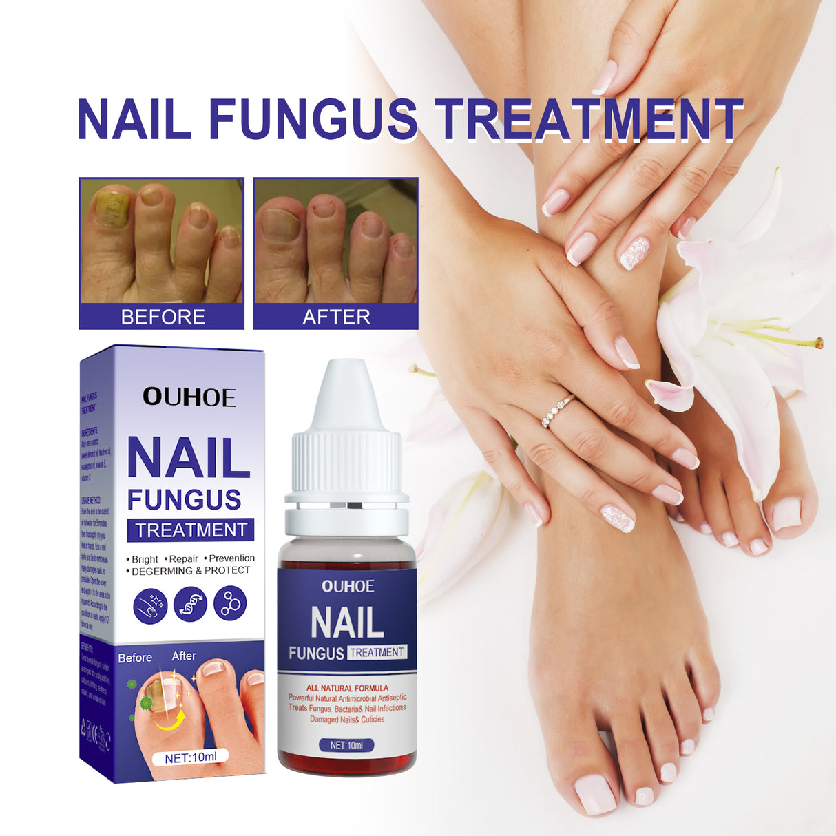 Nail Repair Lotion, Repair Thickening Nail Inlay Gray Nail Shine Soft Nail Care Solution - V.I.P Digital Presence