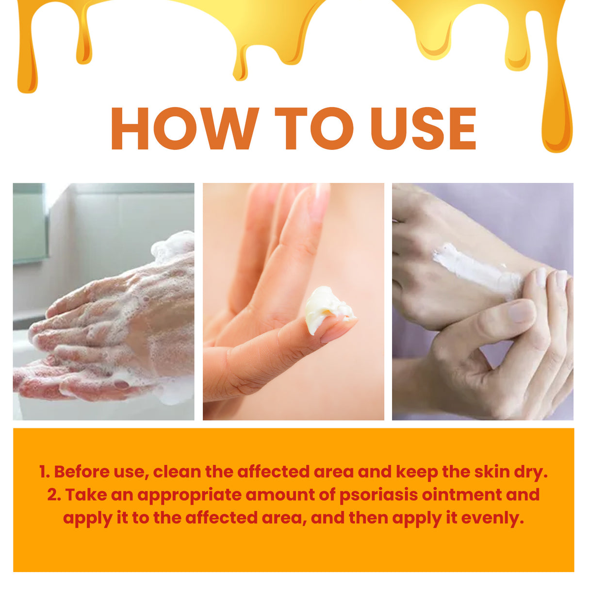 Bee-Poison Cowhide Moss Cream, Which Relieves Redness And Itchiness Of Skin - V.I.P Digital Presence