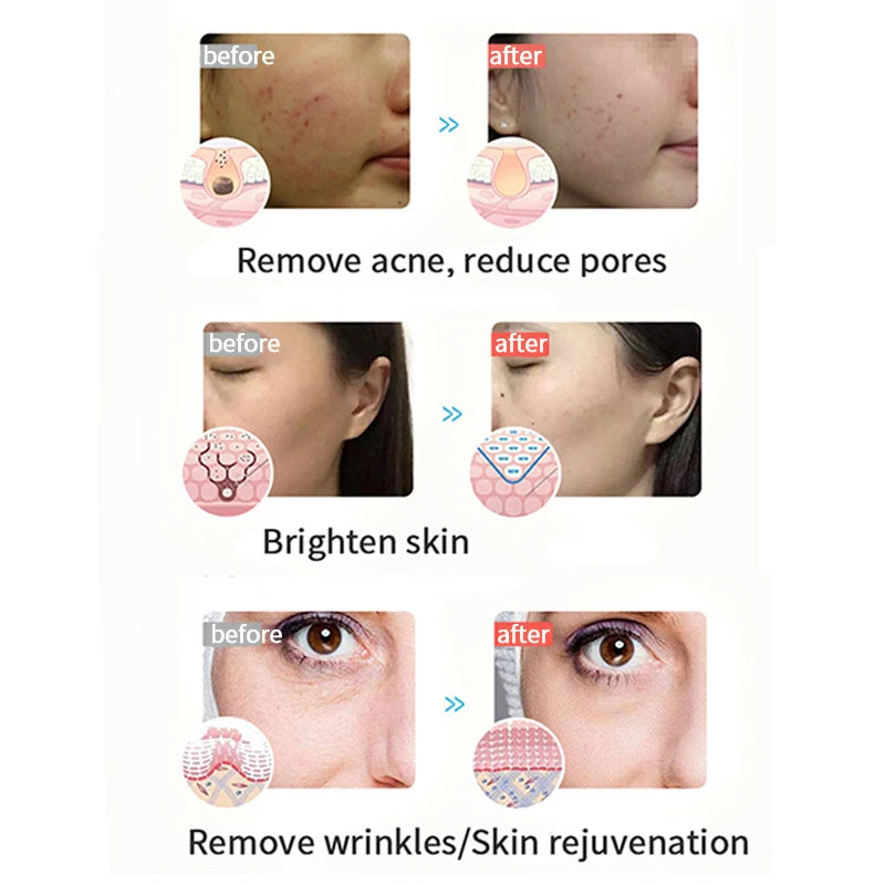 LED Face Light Therapy Photon Facial Mask 3 Color Anti Aging Wrinkle Skin Rejuvenation Skin Care Tool Home Beauty Instrument Spa - V.I.P Digital Presence