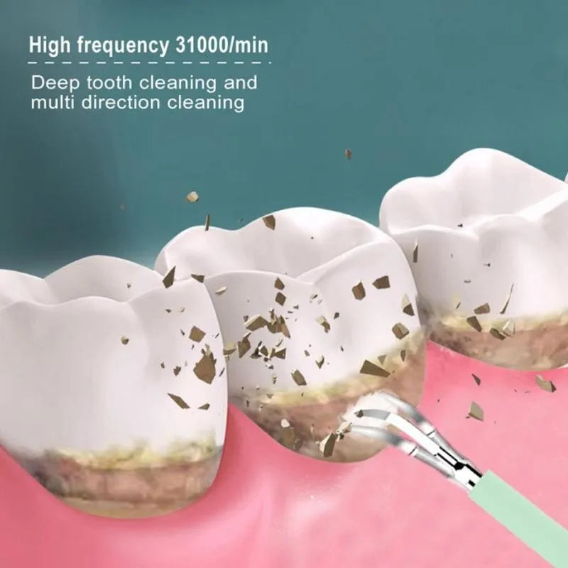 Electric Tartar Remover Tartar Ultrasonic Whitening USB Rechargeable Tooth Cleaner Portable Household Dental Calculus Remover - V.I.P Digital Presence