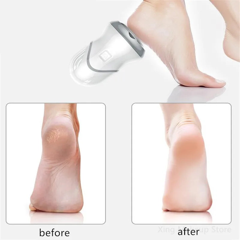 USB Charging Electric Foot Massager - V.I.P Digital Presence