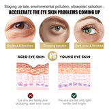 Retinol Eye Cream Stick Reduces Eye Bags, Dark Circles And Wrinkles, Moisturizes And Tightenes The Skin Around The Eyes - V.I.P Digital Presence