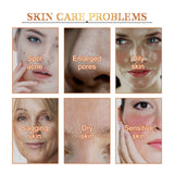 Calendula Peel Mask, Clean Keratin Delicate Pores Brightening Skin And Oil Control Mask