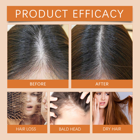 Hair Regrowth Ampoules, Nourish The Scalp To Promote Germinal Nourish Hair Follicle Health Care Essence - V.I.P Digital Presence