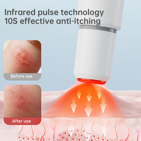 Electronic Mosquito Bite Pen: Chemical-free, natural heat anti-itch for adults, kids, camping, travel. - V.I.P Digital Presence