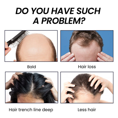 Hair Boost Spray, Ginger Multiflorum Essence Moisturizes Scalp And Prevents Hair Loss - V.I.P Digital Presence